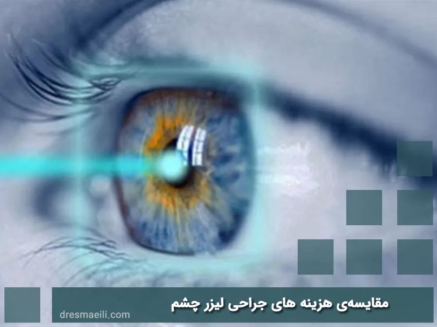 مقایسهی هزینه های جراحی لیزر چشم