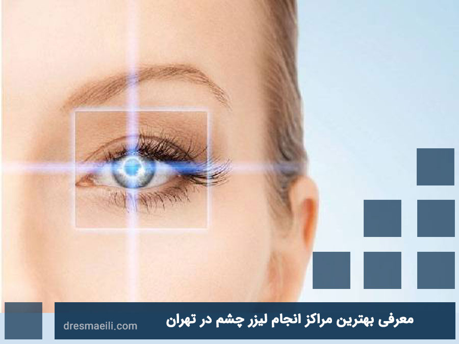 معرفی بهترین مراکز انجام لیزر چشم در تهران دکتر اسماعیلی