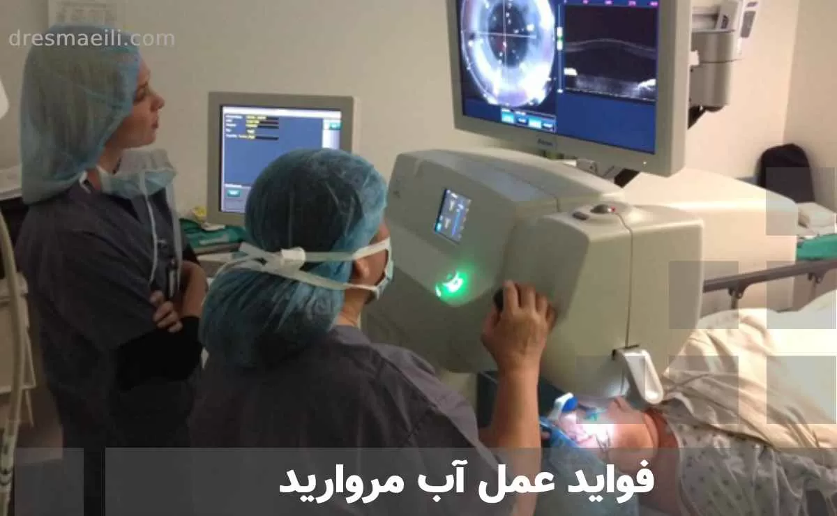 فواید عمل آب مروارید