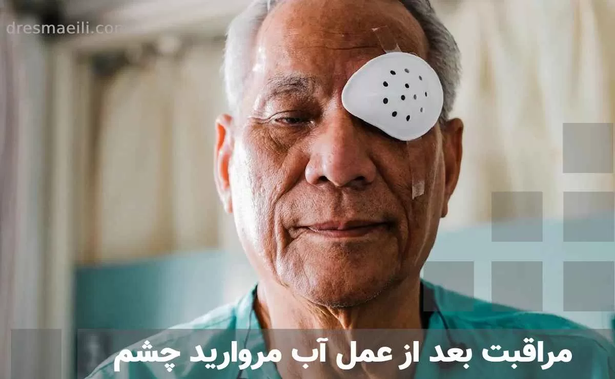 مراقبت بعد از عمل آب مروارید چشم